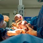 How to take care of yourself after a caesarean section